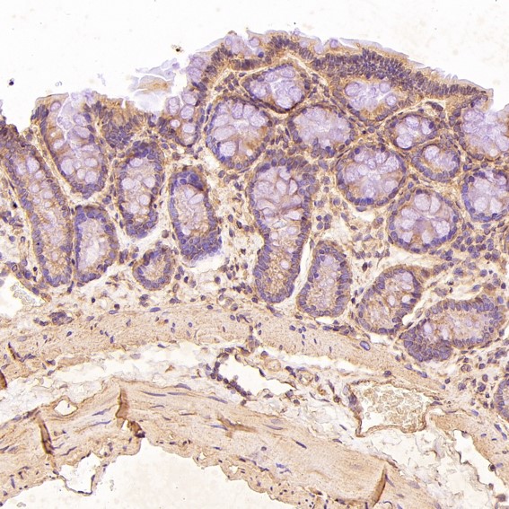 2 - Anti-TRAF6 Rabbit Monoclonal Antibody ABO13596