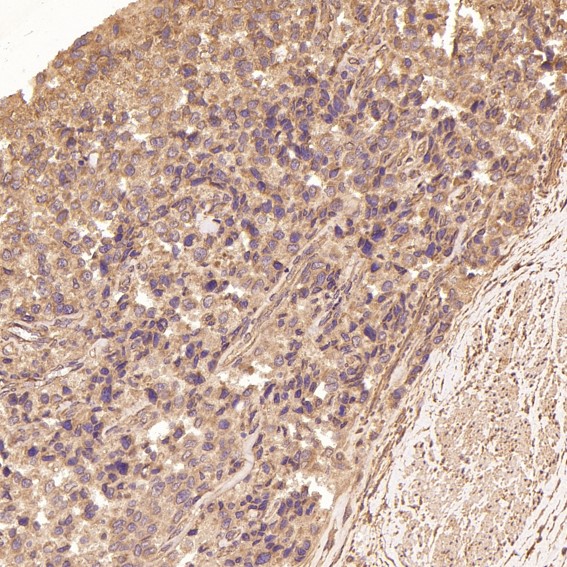 2 - Anti-TRAF6 Rabbit Monoclonal Antibody ABO13596