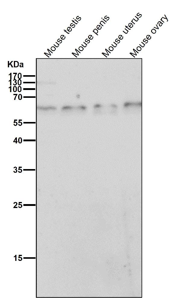 1 - Anti-TRAF6 Rabbit Monoclonal Antibody ABO13596