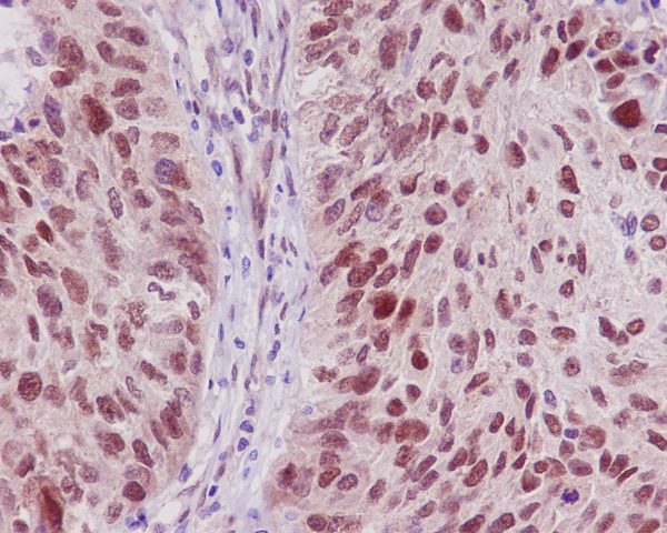 2 - Anti-TRAF6 Rabbit Monoclonal Antibody ABO13597