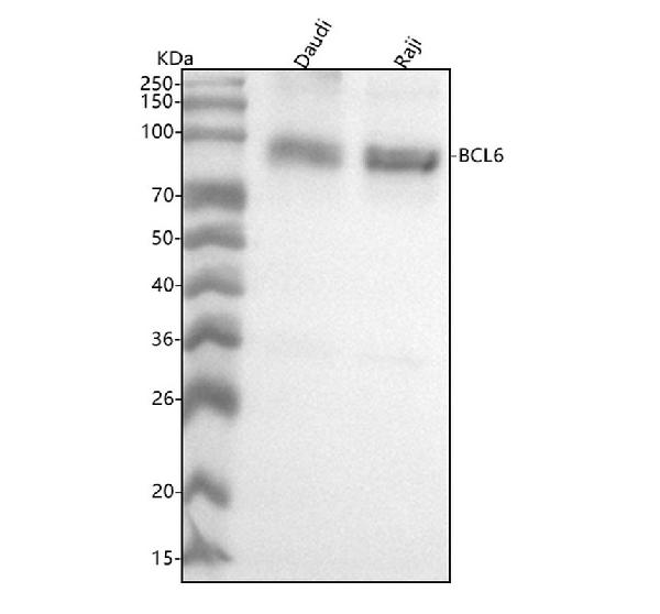 1 - Anti-Bcl-6 Rabbit Monoclonal Antibody ABO13598
