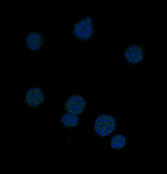 3 - Anti-Bcl-6 Rabbit Monoclonal Antibody ABO13598