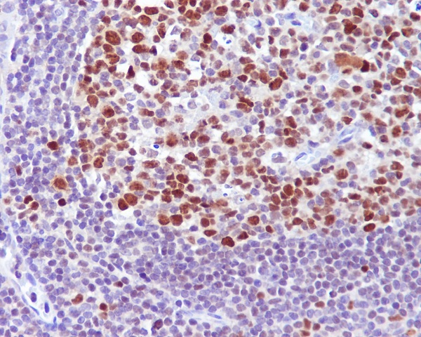 2 - Anti-Bcl-6 Rabbit Monoclonal Antibody ABO13598