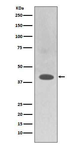 1 - Anti-TRAM2 Rabbit Monoclonal Antibody ABO13599