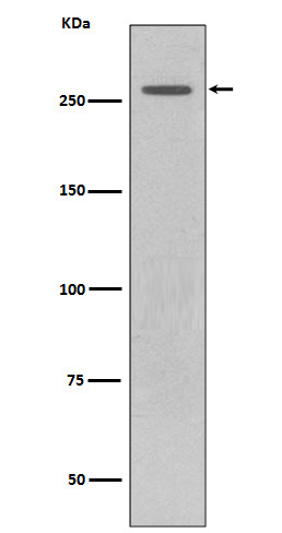 1 - Anti-LRRK2 Rabbit Monoclonal Antibody ABO13601