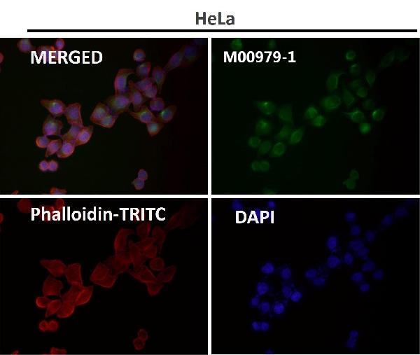 1 - Anti-S100B/S100 Beta Rabbit Monoclonal Antibody ABO13602