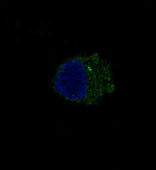 3 - Anti-S100B/S100 Beta Rabbit Monoclonal Antibody ABO13602