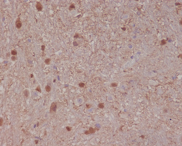 2 - Anti-S100B/S100 Beta Rabbit Monoclonal Antibody ABO13602