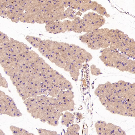 2 - Anti-S100B/S100 Beta Rabbit Monoclonal Antibody ABO13602