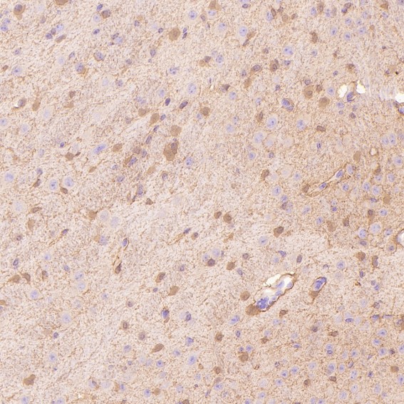 2 - Anti-S100B/S100 Beta Rabbit Monoclonal Antibody ABO13602
