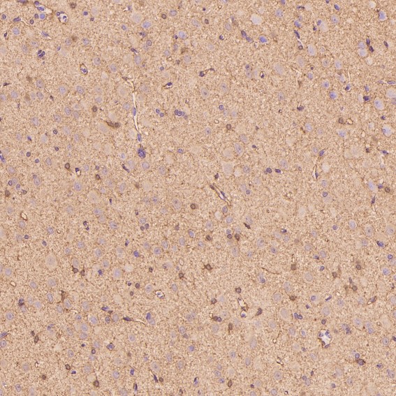 2 - Anti-S100B/S100 Beta Rabbit Monoclonal Antibody ABO13602