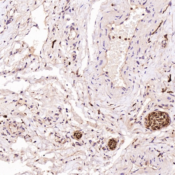 2 - Anti-S100B/S100 Beta Rabbit Monoclonal Antibody ABO13602