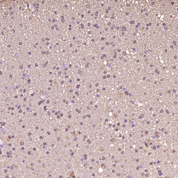 2 - Anti-S100B/S100 Beta Rabbit Monoclonal Antibody ABO13602