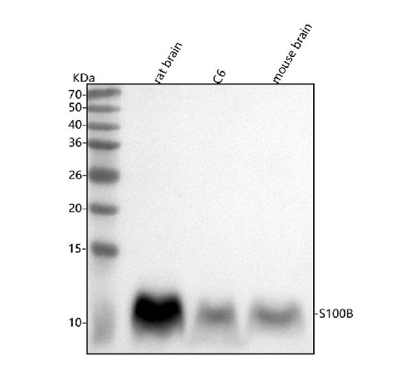 1 - Anti-S100B/S100 Beta Rabbit Monoclonal Antibody ABO13602