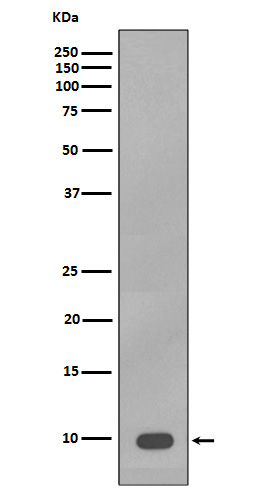 1 - Anti-S100B/S100 Beta Rabbit Monoclonal Antibody ABO13602