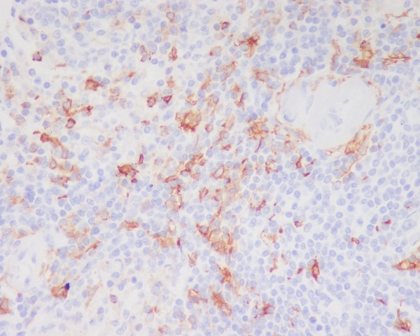 2 - Anti-CD11c ITGAX Rabbit Monoclonal Antibody ABO13603