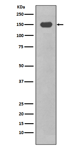 1 - Anti-CD11c ITGAX Rabbit Monoclonal Antibody ABO13603