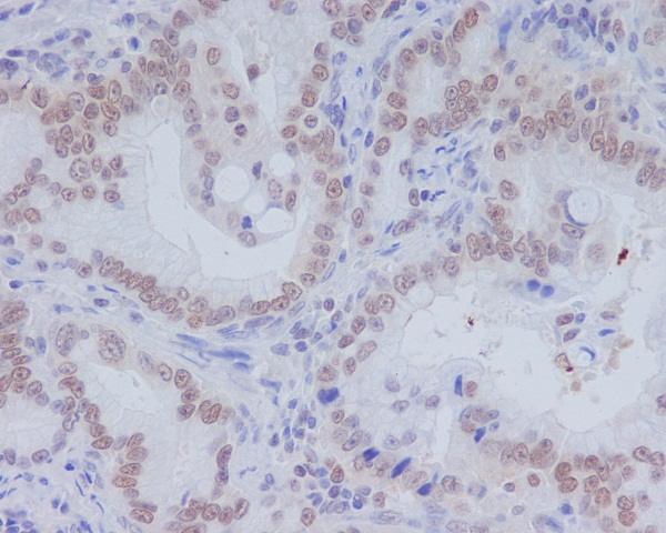 2 - Anti-CD11b ITGAM Rabbit Monoclonal Antibody ABO13604