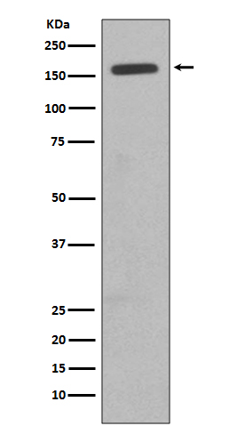 1 - Anti-CD11b ITGAM Rabbit Monoclonal Antibody ABO13604
