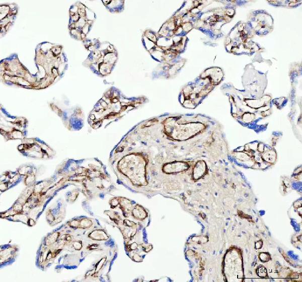 2 - Anti-CD146 MCAM Rabbit Monoclonal Antibody ABO13605