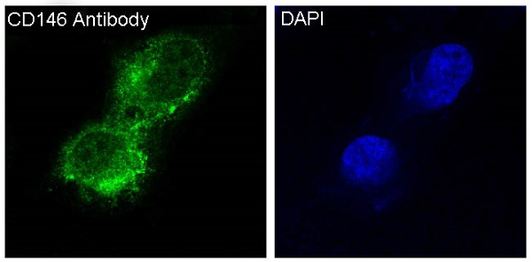 3 - Anti-CD146 MCAM Rabbit Monoclonal Antibody ABO13605