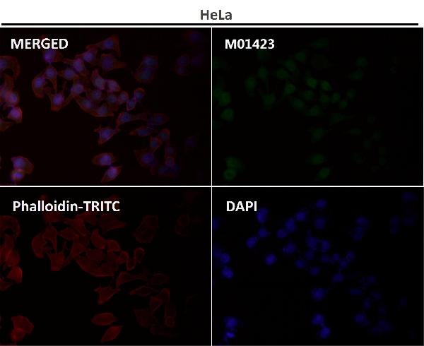 1 - Anti-Smad5 Rabbit Monoclonal Antibody ABO13606