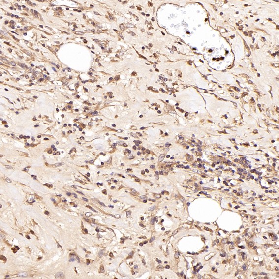 2 - Anti-Smad5 Rabbit Monoclonal Antibody ABO13606