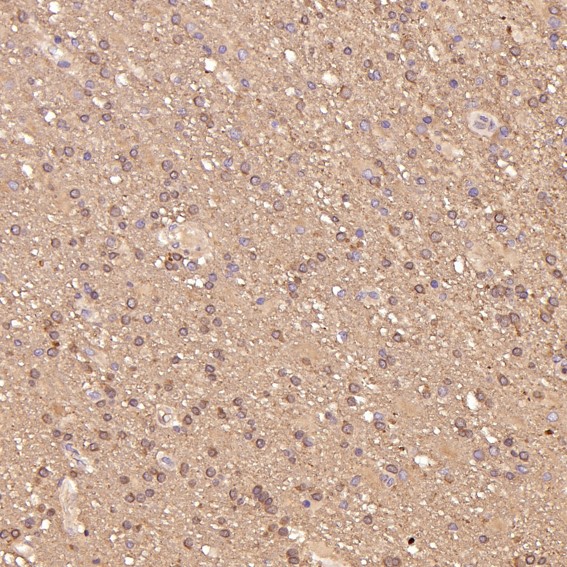 2 - Anti-Smad5 Rabbit Monoclonal Antibody ABO13606