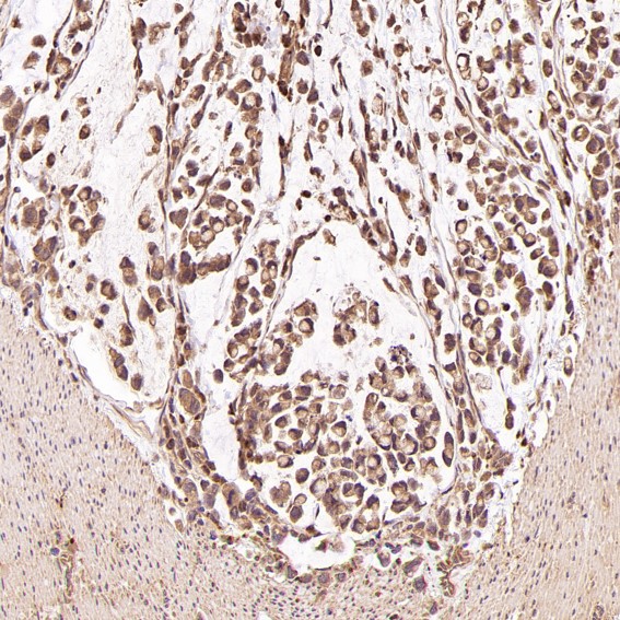 2 - Anti-Smad5 Rabbit Monoclonal Antibody ABO13606