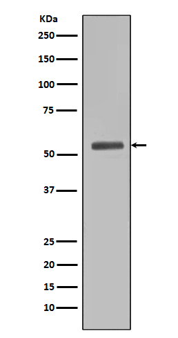 1 - Anti-Smad5 Rabbit Monoclonal Antibody ABO13606