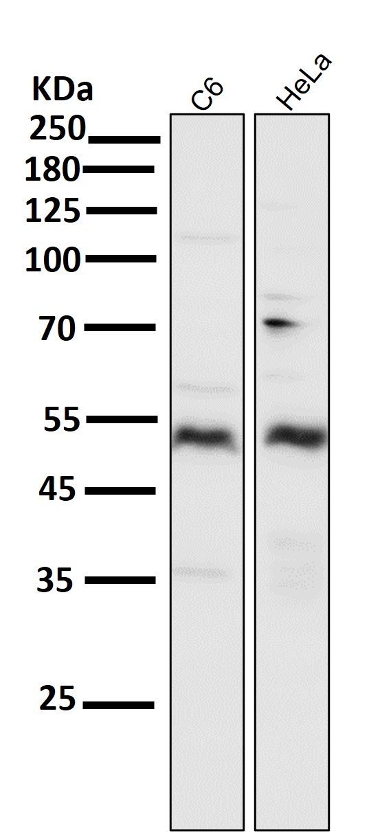 1 - Anti-Smad5 Rabbit Monoclonal Antibody ABO13606