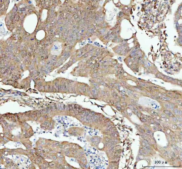 2 - Anti-STAT1 Rabbit Monoclonal Antibody ABO13607