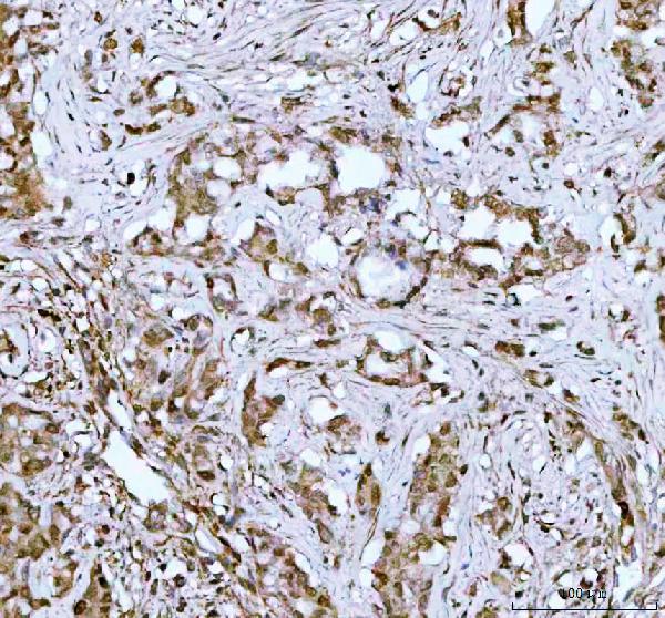 2 - Anti-STAT1 Rabbit Monoclonal Antibody ABO13607