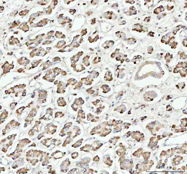 2 - Anti-STAT1 Rabbit Monoclonal Antibody ABO13607