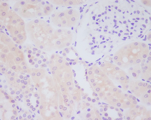 2 - Anti-MMP14/Mt1 Mmp Rabbit Monoclonal Antibody ABO13608