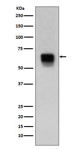 1 - Anti-MMP14/Mt1 Mmp Rabbit Monoclonal Antibody ABO13608