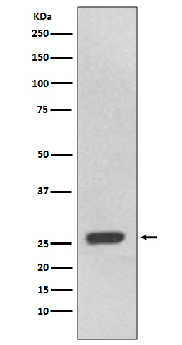 1 - Anti-UCHL3 Rabbit Monoclonal Antibody ABO13609