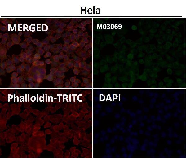1 - Anti-TRAF4 Rabbit Monoclonal Antibody ABO13610