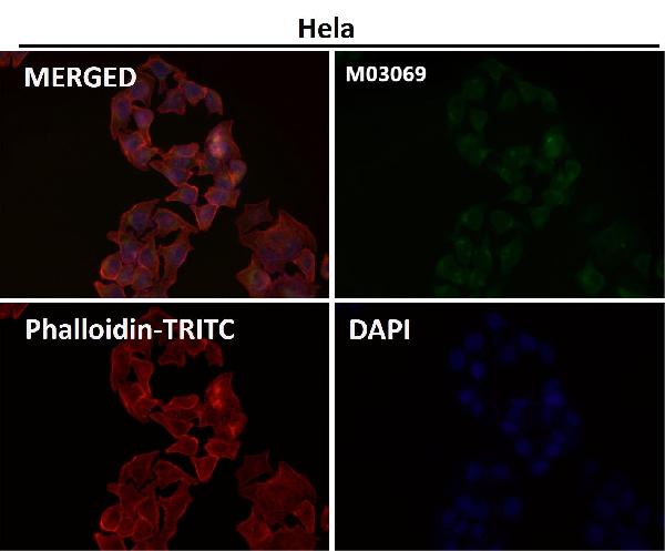 1 - Anti-TRAF4 Rabbit Monoclonal Antibody ABO13610