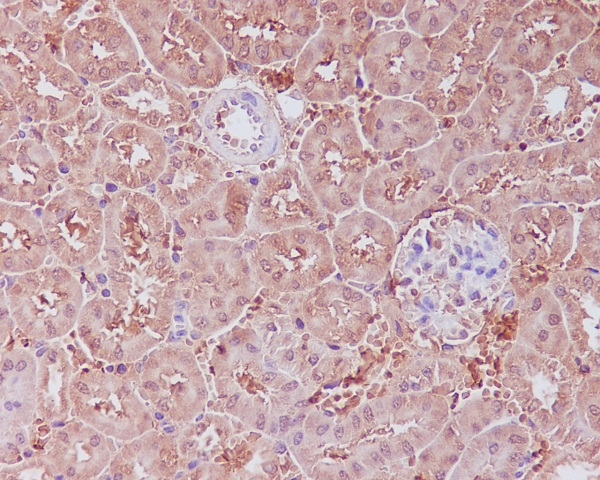 2 - Anti-APAF1 Rabbit Monoclonal Antibody ABO13611