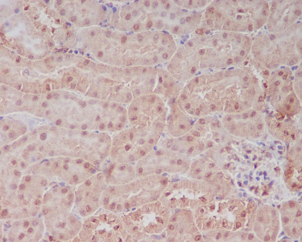 2 - Anti-PELP1 Rabbit Monoclonal Antibody ABO13612