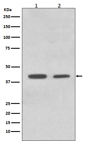 1 - Anti-ACADM/Mcad Rabbit Monoclonal Antibody ABO13613
