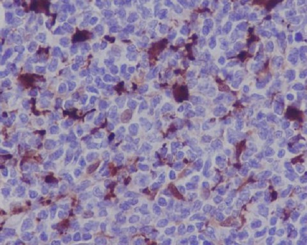 2 - Anti-MERTK/Mer Rabbit Monoclonal Antibody ABO13614