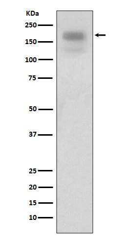 1 - Anti-MERTK/Mer Rabbit Monoclonal Antibody ABO13614