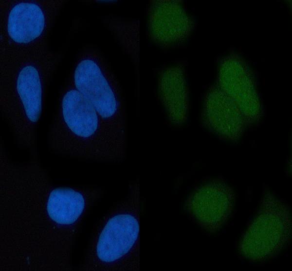 3 - Anti-c-Jun Rabbit Monoclonal Antibody ABO13615
