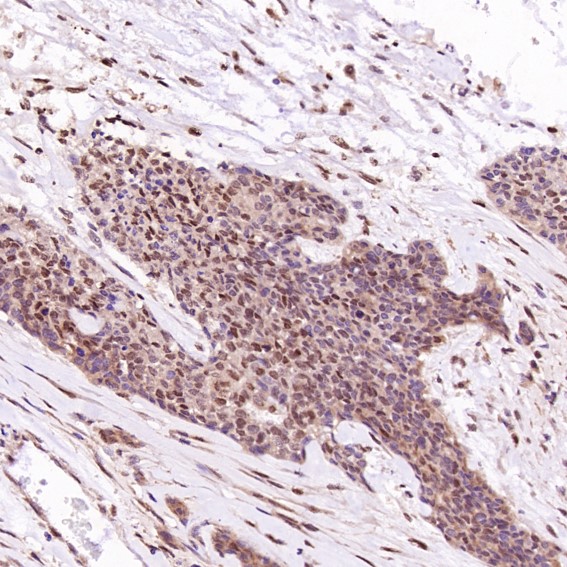 2 - Anti-c-Jun Rabbit Monoclonal Antibody ABO13615