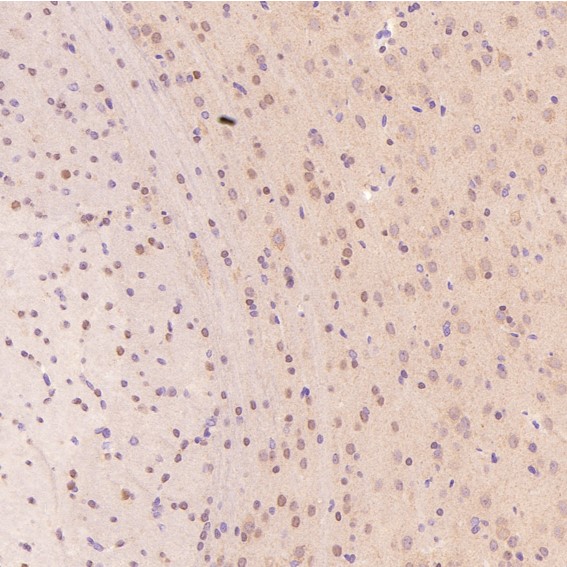 2 - Anti-c-Jun Rabbit Monoclonal Antibody ABO13615