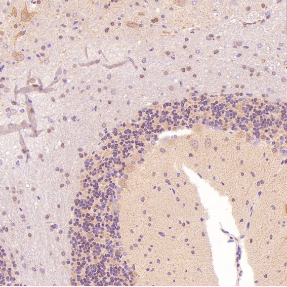 2 - Anti-c-Jun Rabbit Monoclonal Antibody ABO13615