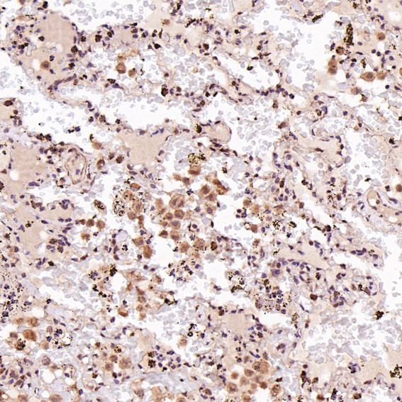 2 - Anti-c-Jun Rabbit Monoclonal Antibody ABO13615