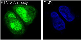 3 - Anti-STAT3 Rabbit Monoclonal Antibody ABO13616